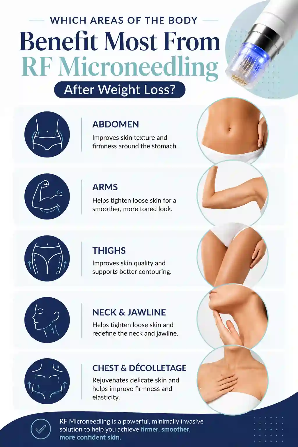 Which Areas of the Body Benefit Most From RF Microneedling After Weight Loss Oxford